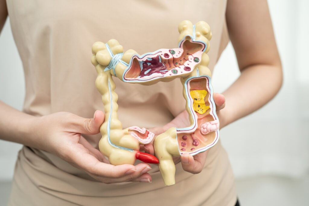Woman with intestine anatomy model for digestive health education
