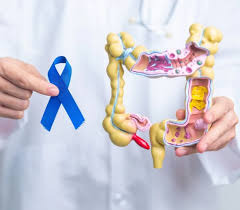 Colorectal Cancer Awareness: A Preventable Burden and an Integrative Path Forward